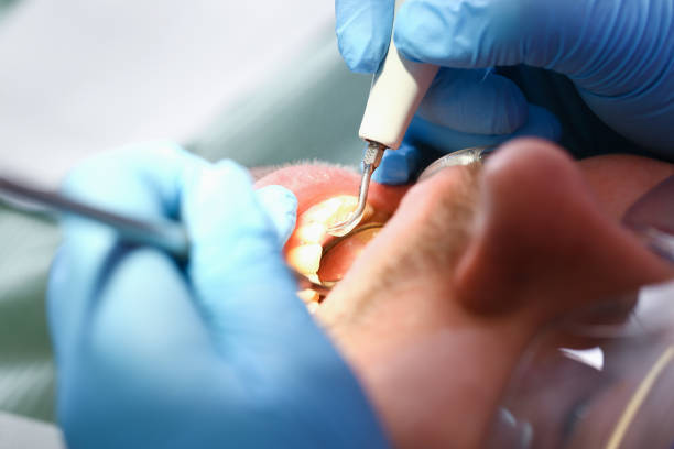 Best Walk-In Emergency Dental Services in Combine, TX