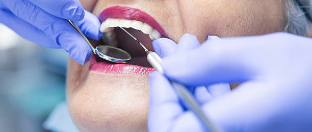 Best Broken or Chipped Tooth Repair in Combine, TX